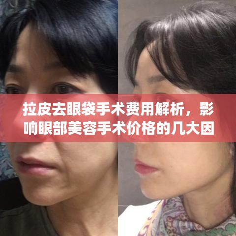 拉皮去眼袋手术费用解析，影响眼部美容手术价格的几大因素