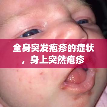 全身突发疱疹的症状，身上突然疱疹 